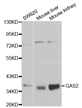 GAS2 Antibody in Western Blot (WB)