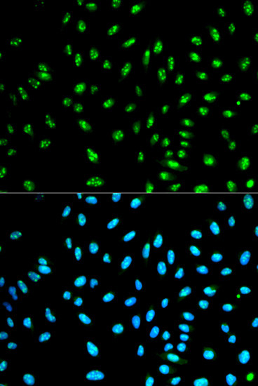 NCF2 Antibody in Immunocytochemistry (ICC/IF)