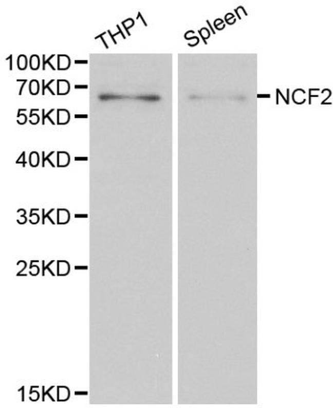 NCF2 Antibody in Western Blot (WB)