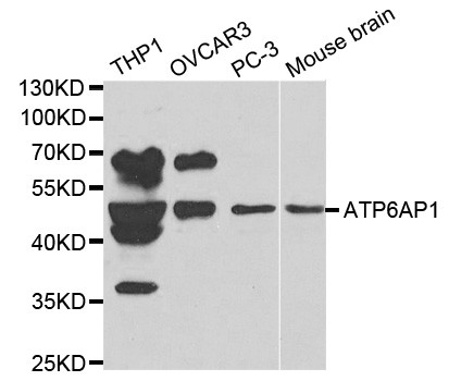 ATP6AP1 Antibody in Western Blot (WB)