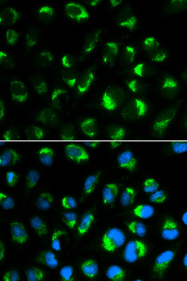 SHMT2 Antibody in Immunocytochemistry (ICC/IF)