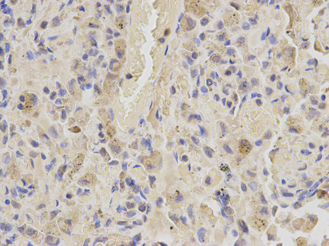 SHMT2 Antibody in Immunohistochemistry (Paraffin) (IHC (P))