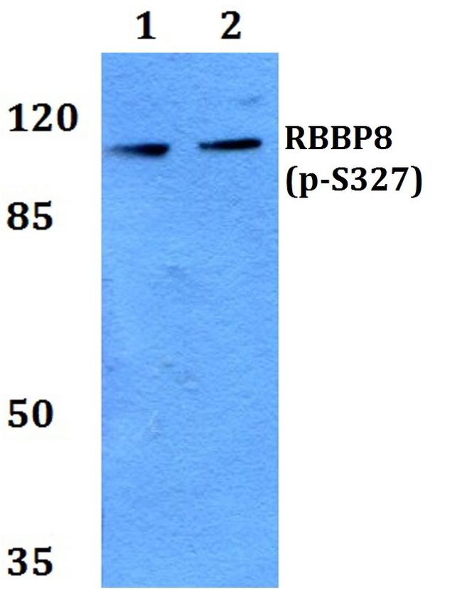 Phospho-CtIP (Ser327) Antibody in Western Blot (WB)