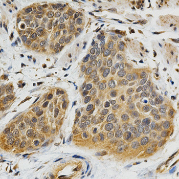 ABO Antibody in Immunohistochemistry (Paraffin) (IHC (P))