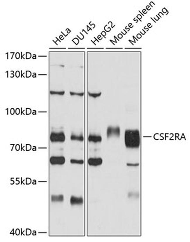 CSF2RA Antibody in Western Blot (WB)