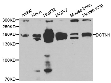 Dynactin 1 Antibody in Western Blot (WB)