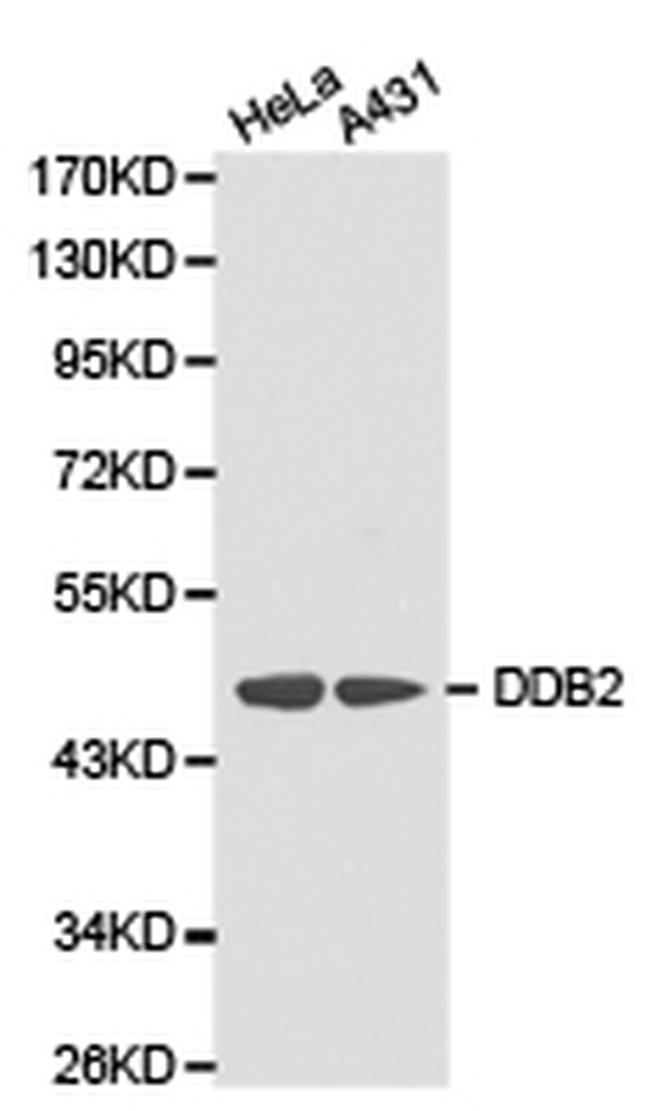 DDB2 Antibody in Western Blot (WB)