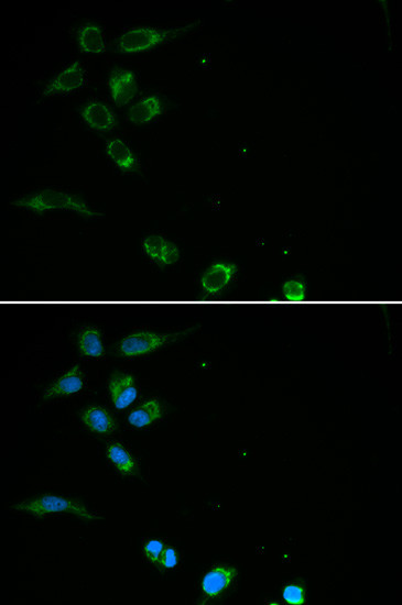 HFE Antibody in Immunocytochemistry (ICC/IF)