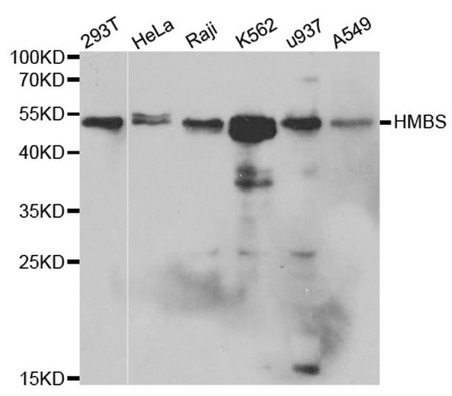 HMBS Antibody in Western Blot (WB)