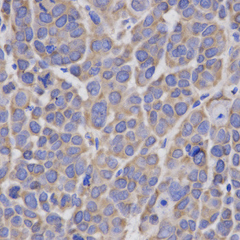 HMGCR Antibody in Immunohistochemistry (Paraffin) (IHC (P))