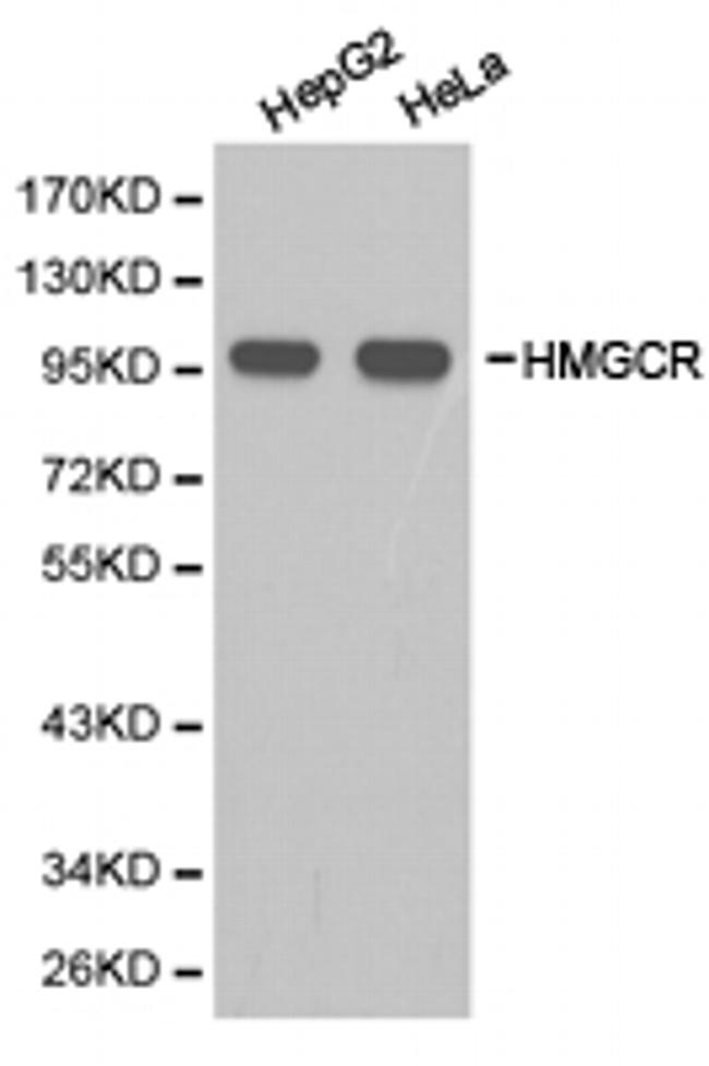 HMGCR Antibody in Western Blot (WB)