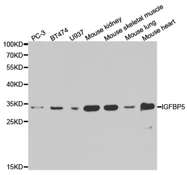 IGFBP5 Antibody in Western Blot (WB)