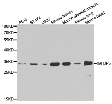 IGFBP5 Antibody in Western Blot (WB)