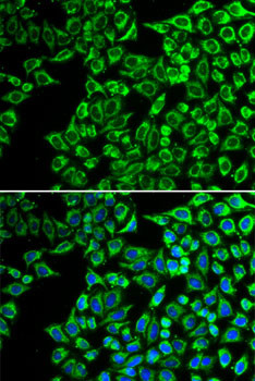 LIPC Antibody in Immunocytochemistry (ICC/IF)