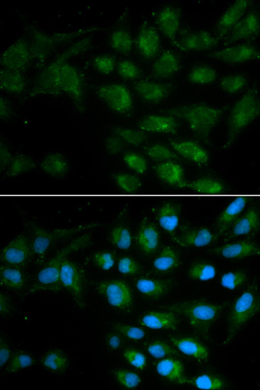 LIPC Antibody in Immunocytochemistry (ICC/IF)