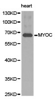 MYOC Antibody in Western Blot (WB)