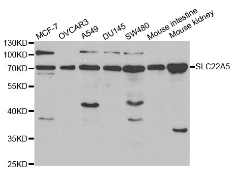 SLC22A5 Antibody in Western Blot (WB)