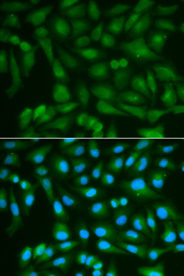 Sorbitol Dehydrogenase Antibody in Immunocytochemistry (ICC/IF)