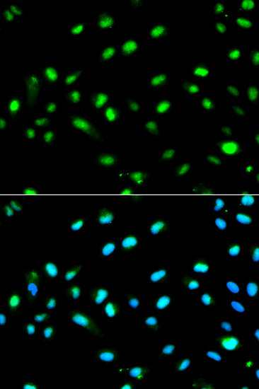 LETMD1 Antibody in Immunocytochemistry (ICC/IF)