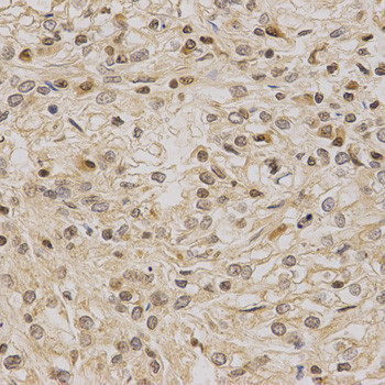 LETMD1 Antibody in Immunohistochemistry (Paraffin) (IHC (P))