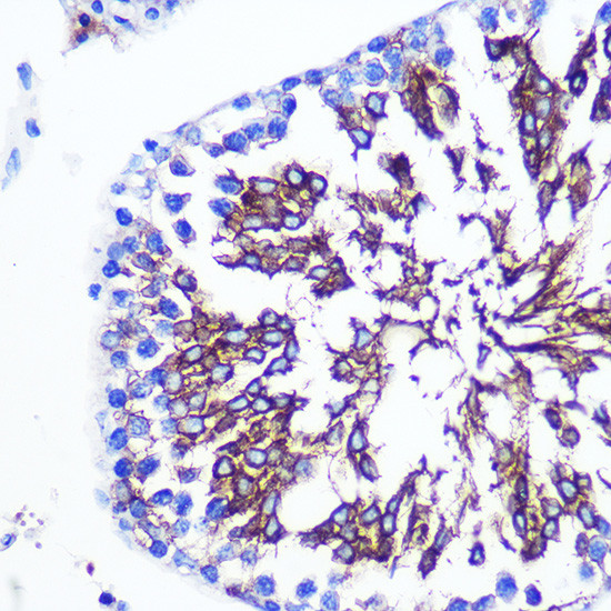 LETMD1 Antibody in Immunohistochemistry (Paraffin) (IHC (P))