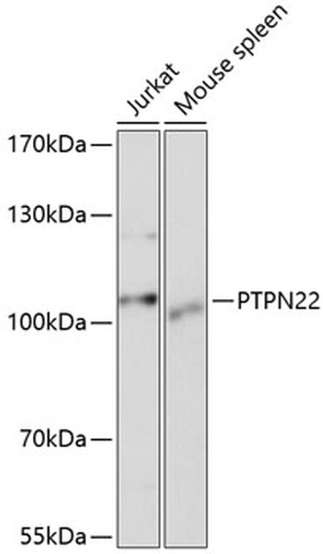 PTPN22 Antibody in Western Blot (WB)