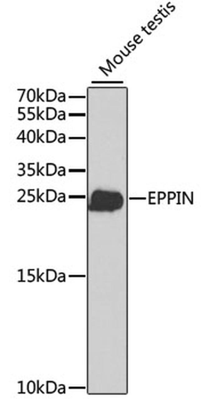 SPINLW1 Antibody in Western Blot (WB)