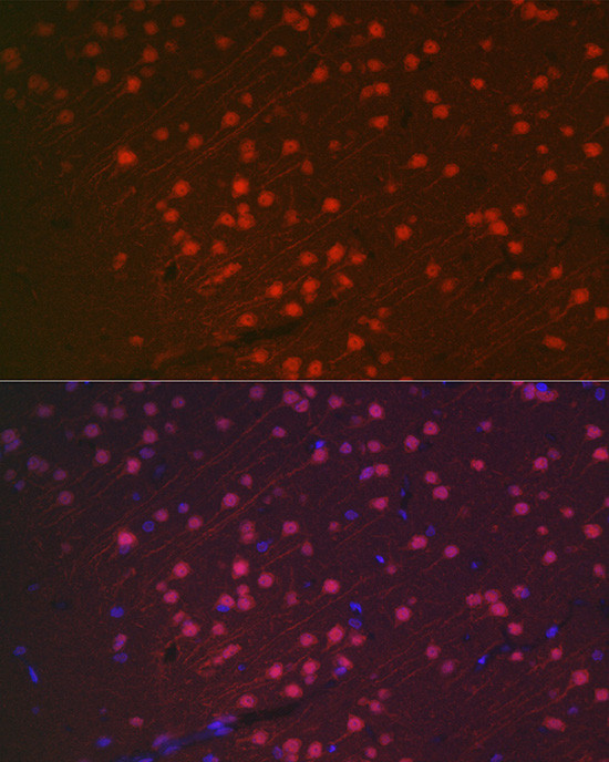 NeuN Antibody in Immunocytochemistry (ICC/IF)