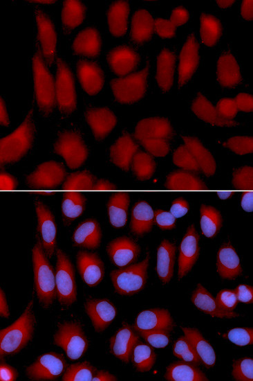 TAP2 Antibody in Immunocytochemistry (ICC/IF)