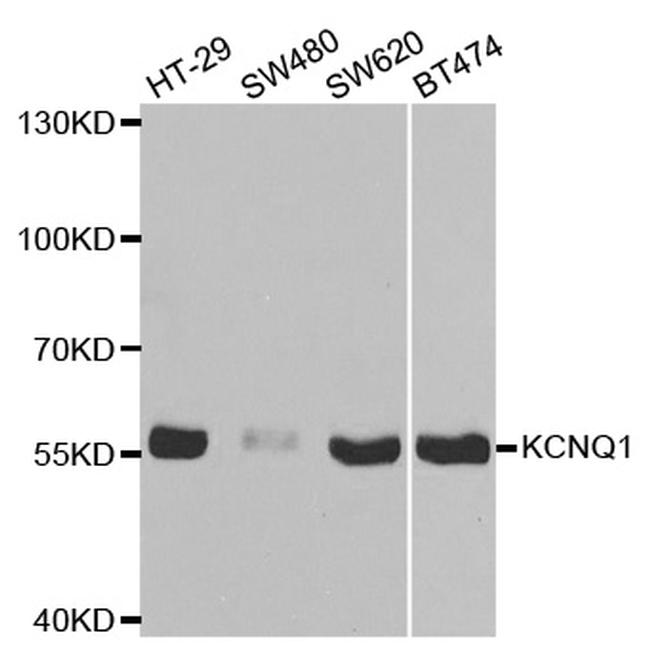 KCNQ1 Antibody in Western Blot (WB)