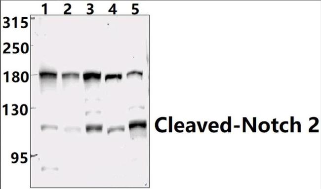 NOTCH2 (Cleaved Ala1734) Antibody in Western Blot (WB)