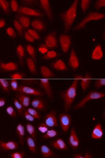 UHRF1 Antibody in Immunocytochemistry (ICC/IF)