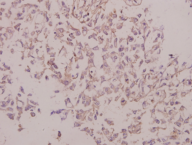 Laminin gamma-3 Antibody in Immunohistochemistry (Paraffin) (IHC (P))