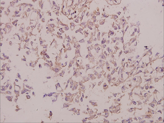 Laminin gamma-3 Antibody in Immunohistochemistry (Paraffin) (IHC (P))