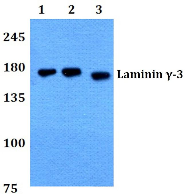 Laminin gamma-3 Antibody in Western Blot (WB)