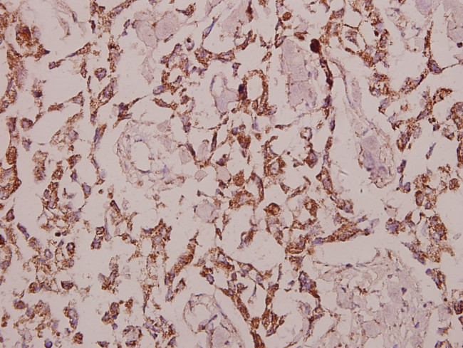 GCP3 Antibody in Immunohistochemistry (Paraffin) (IHC (P))