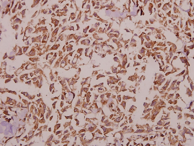 Kir2.1 (KCNJ2) Antibody in Immunohistochemistry (Paraffin) (IHC (P))