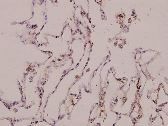 TAUT Antibody in Immunohistochemistry (Paraffin) (IHC (P))