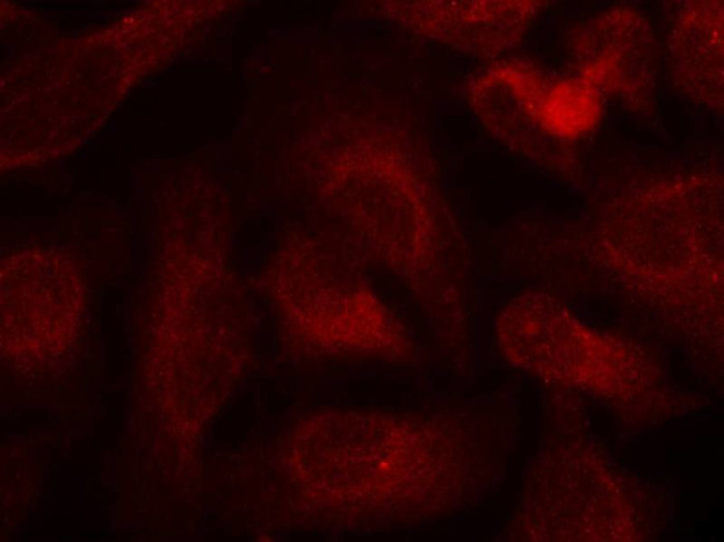 Phospho-ABL1/ABL2 (Tyr393, Tyr439) Antibody in Immunocytochemistry (ICC/IF)