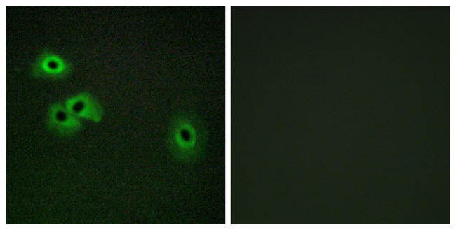 Phospho-Calmodulin (Thr79, Ser81) Antibody in Immunocytochemistry (ICC/IF)