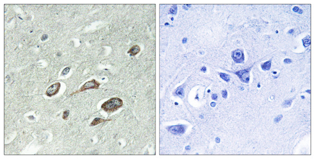 Phospho-Calmodulin (Thr79, Ser81) Antibody in Immunohistochemistry (Paraffin) (IHC (P))