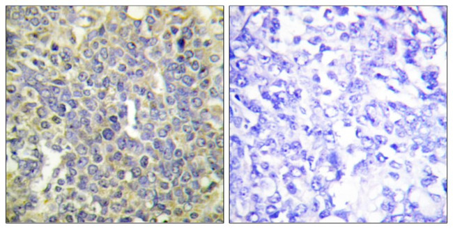 Phospho-Caspase 9 (Thr125) Antibody in Immunohistochemistry (Paraffin) (IHC (P))