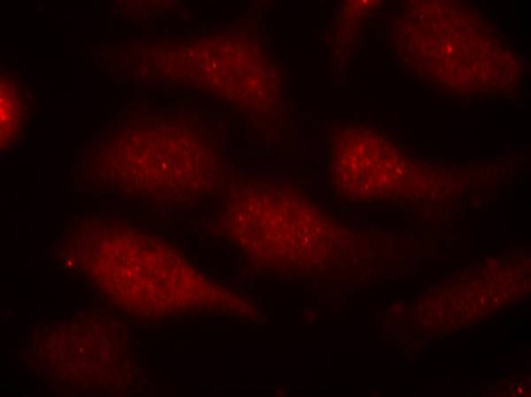 Phospho-CDK6 (Tyr24) Antibody in Immunocytochemistry (ICC/IF)