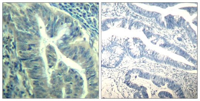 Phospho-CDK6 (Tyr24) Antibody in Immunohistochemistry (Paraffin) (IHC (P))