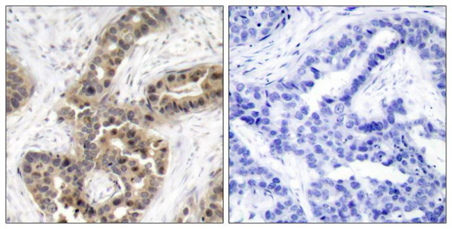 Phospho-p21 (Thr145) Antibody in Immunohistochemistry (Paraffin) (IHC (P))