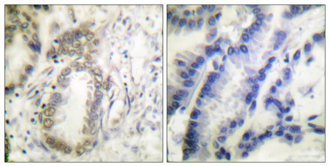 Phospho-C/EBP alpha (Ser21) Antibody in Immunohistochemistry (Paraffin) (IHC (P))