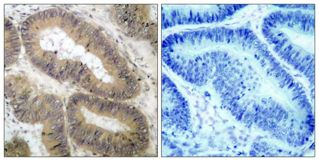 Phospho-IKK alpha (Thr23) Antibody in Immunohistochemistry (Paraffin) (IHC (P))