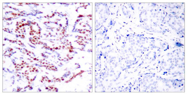 Phospho-ATF2 (Ser94, Ser112) Antibody in Immunohistochemistry (Paraffin) (IHC (P))