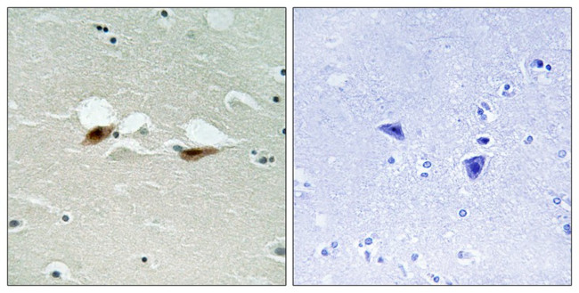 Phospho-ATF2 (Ser472) Antibody in Immunohistochemistry (Paraffin) (IHC (P))