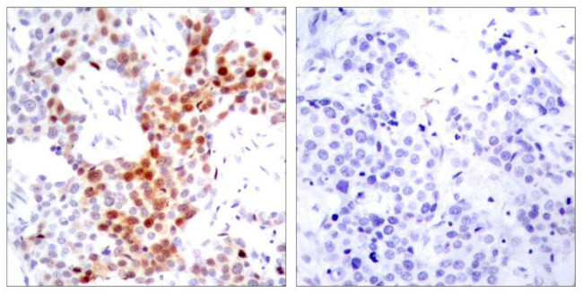 Phospho-ATF2 (Thr51, Thr69) Antibody in Immunohistochemistry (Paraffin) (IHC (P))